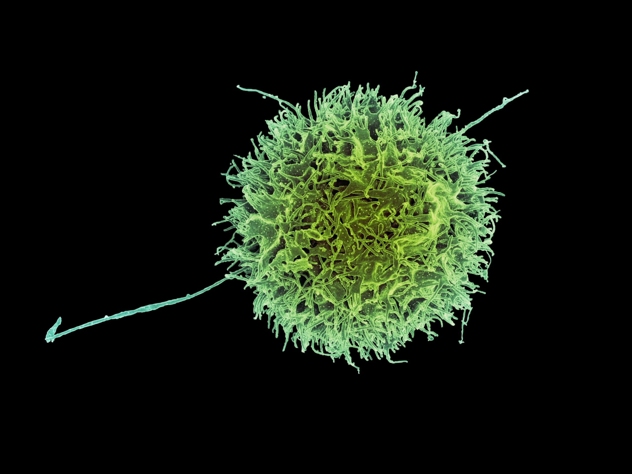 Natural Killer (NK) Cell Therapy